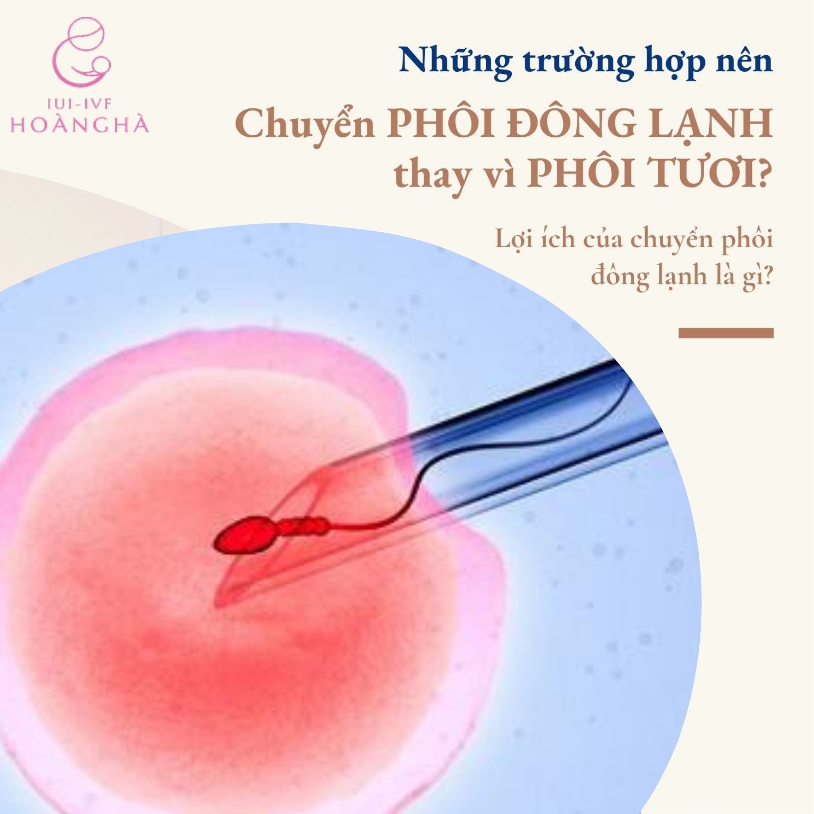 NHỮNG TRƯỜNG HỢP NÊN CHUYỂN PHÔI ĐÔNG LẠNH THAY VÌ PHÔI TƯƠI???